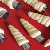 5Pcs/set Stainless Steel Spiral Croissants Molds Conical Tube Cone Roll Cream Baking Pastry Tool